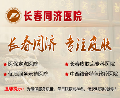 长春皮肤病医院