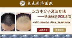 长春治疗脱发