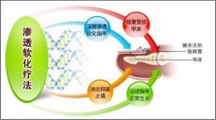 灰指甲治疗